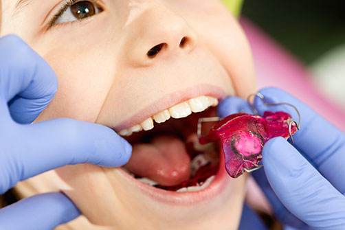 Orthodontics for Children, Vancouver