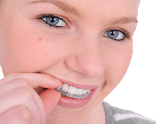 Invisalign for Teens, Greater Vancouver Orthodontics
