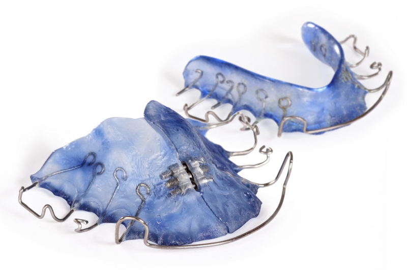 Retainers & Expanders, Greater Vancouver Orthodontics